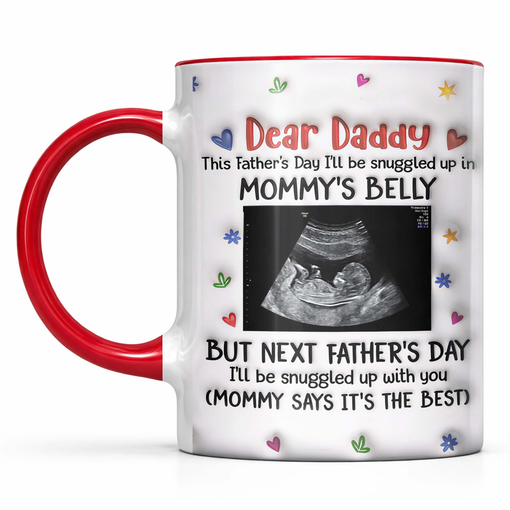 Personalized Accent Mug Custom Ultrasound Photo Gift for Dad Accent Mug GradoCreations