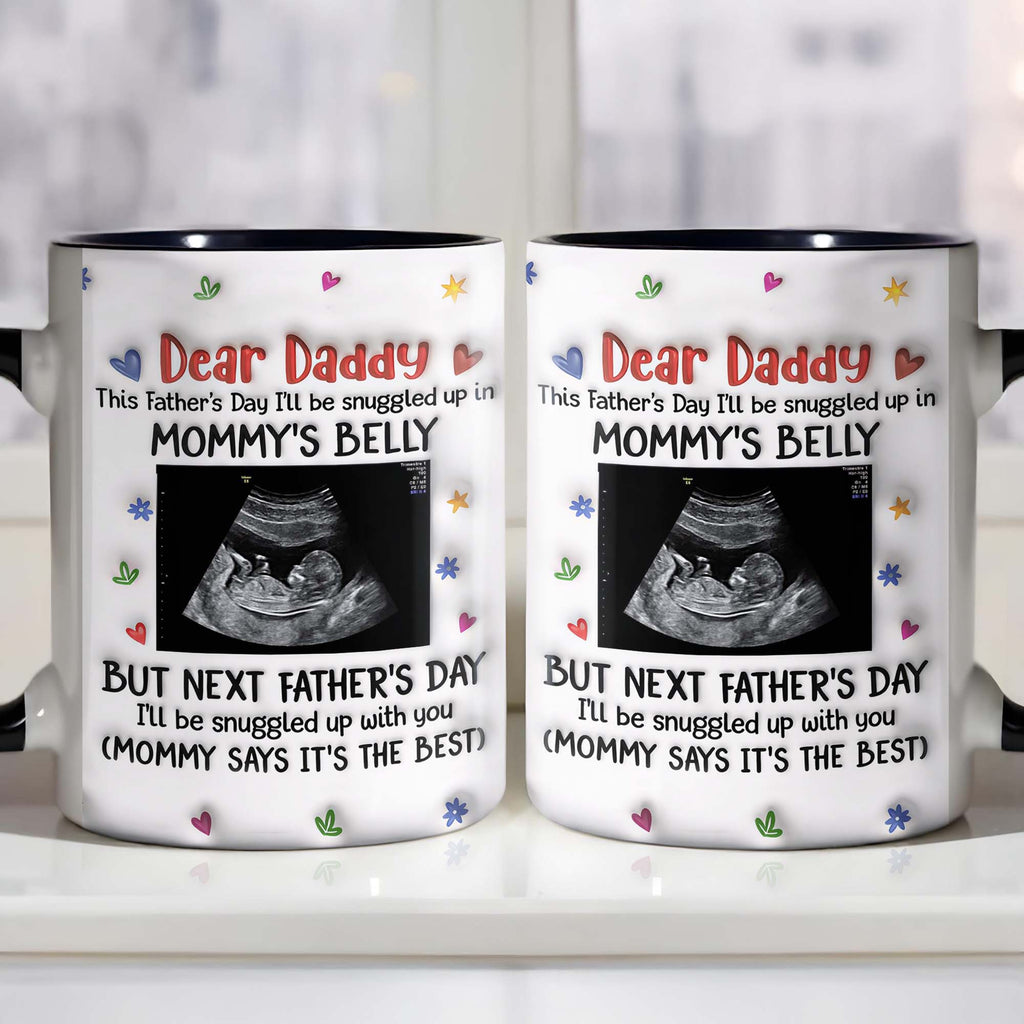 Personalized Accent Mug Custom Ultrasound Photo Gift for Dad Accent Mug GradoCreations