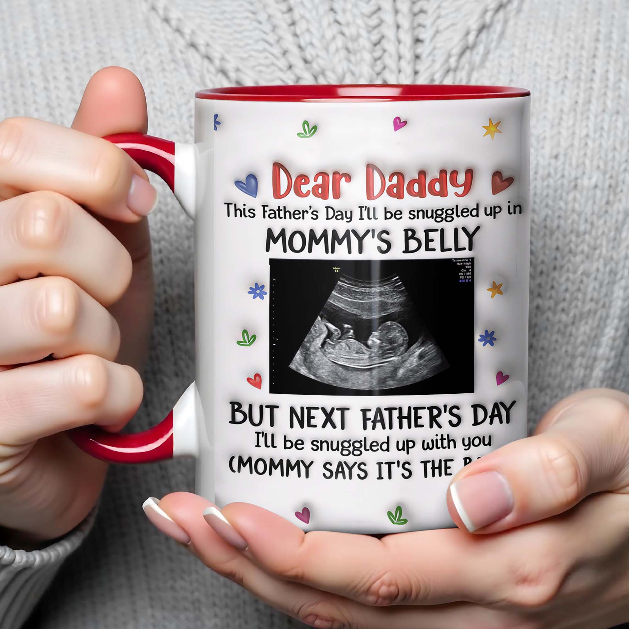 Personalized Accent Mug Custom Ultrasound Photo Gift for Dad