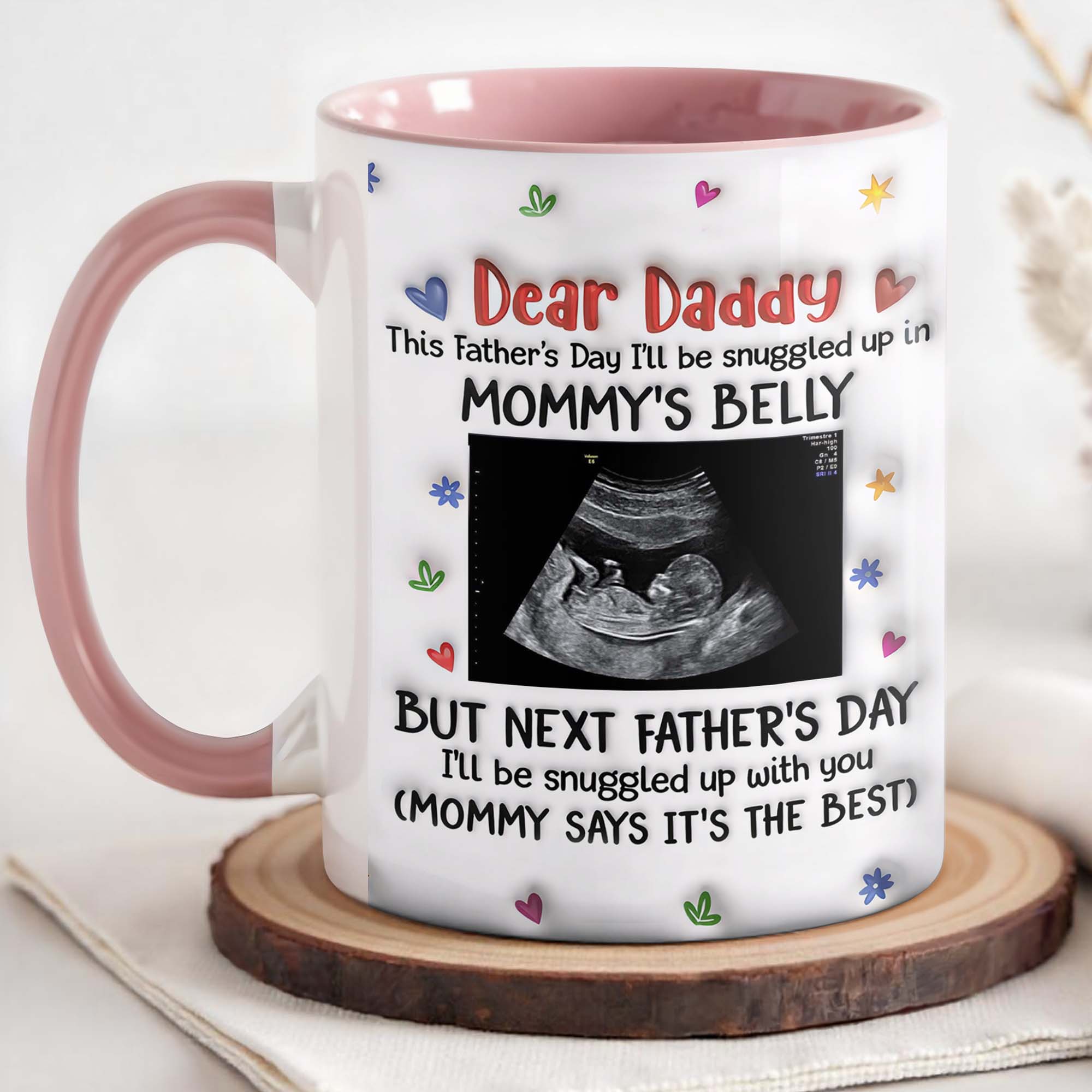 Personalized Accent Mug Custom Ultrasound Photo Gift for Dad