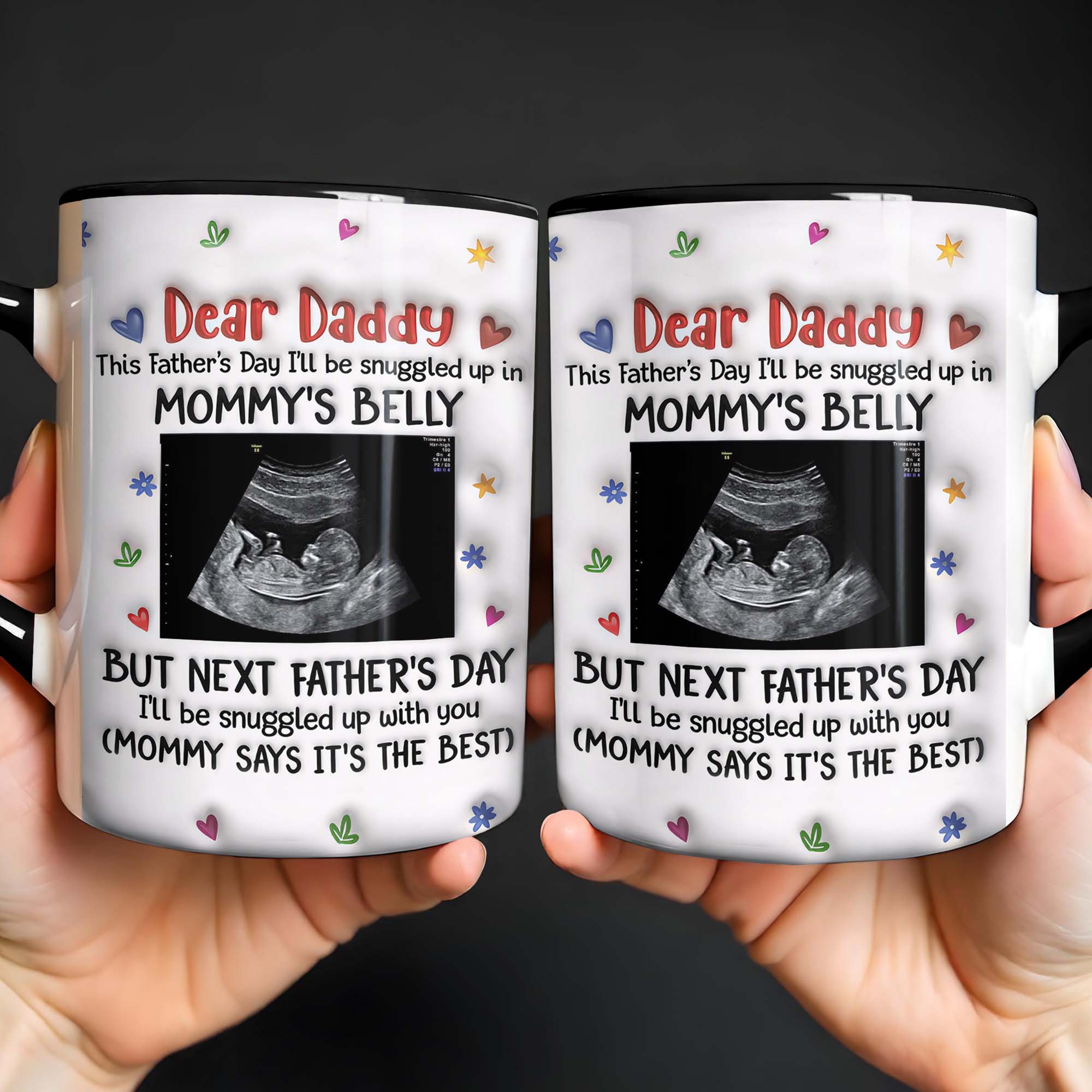 Personalized Accent Mug Custom Ultrasound Photo Gift for Dad