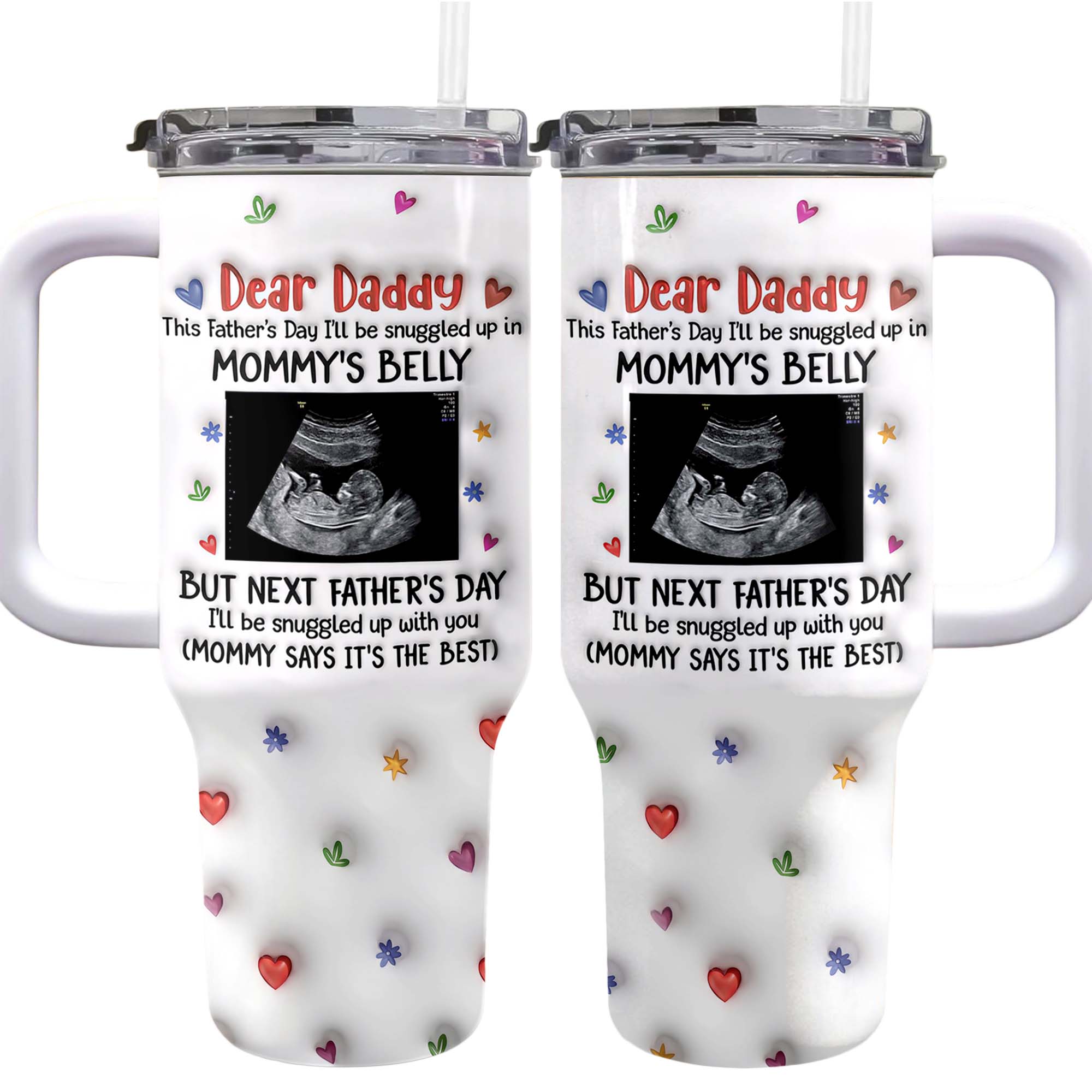 Personalized 40oz Tumbler for Dad with Ultrasound Design Gift 40oz Tumbler GradoCreations