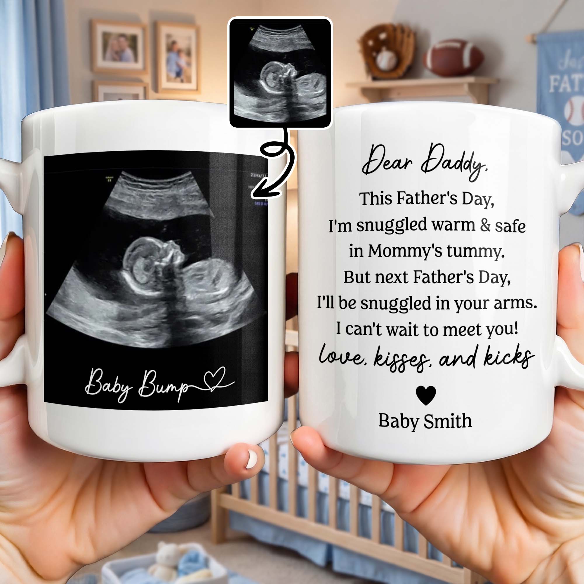 Personalized Father's Day Photo Mug Custom Ultrasound Gift for Dad Edge-to-edge Mug GradoCreations
