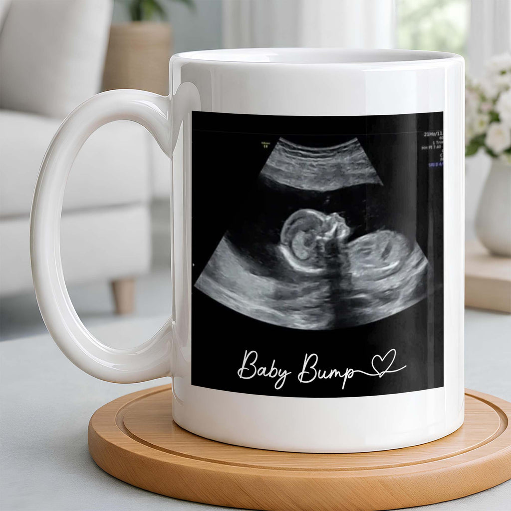 Personalized Father's Day Photo Mug Custom Ultrasound Gift for Dad Edge-to-edge Mug GradoCreations
