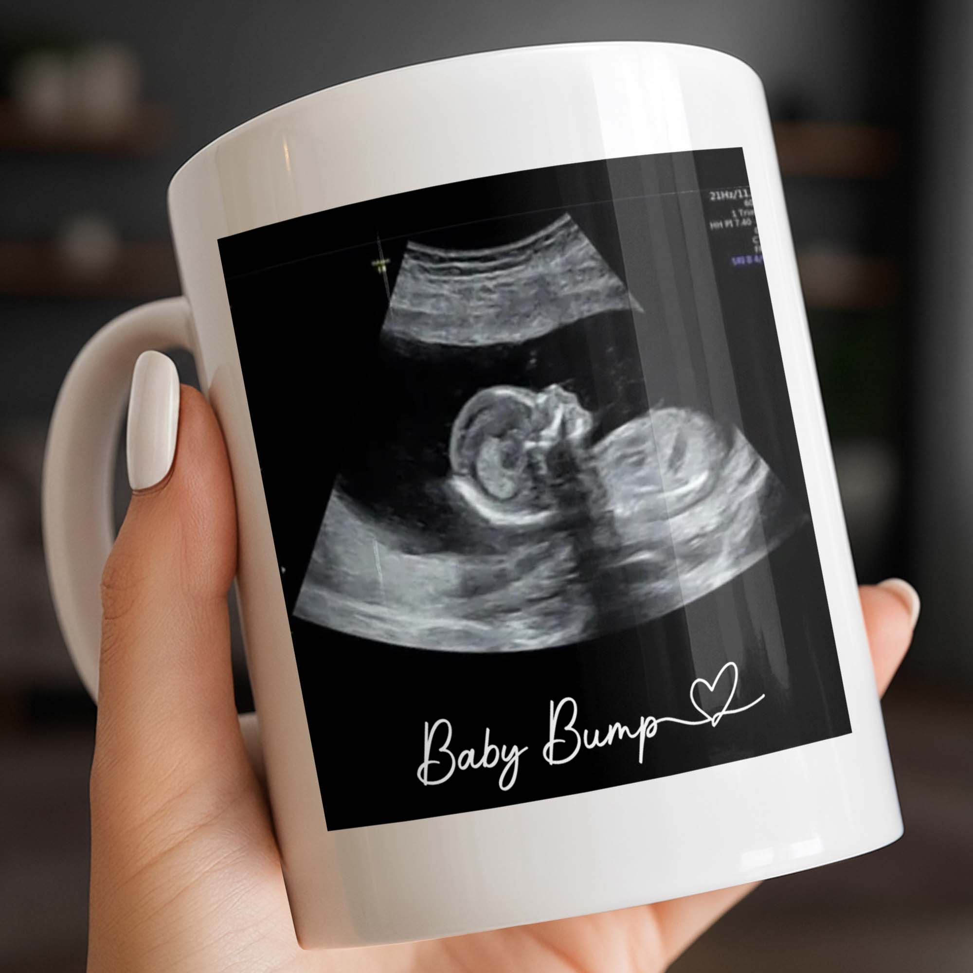 Personalized Father's Day Photo Mug Custom Ultrasound Gift for Dad Edge-to-edge Mug GradoCreations