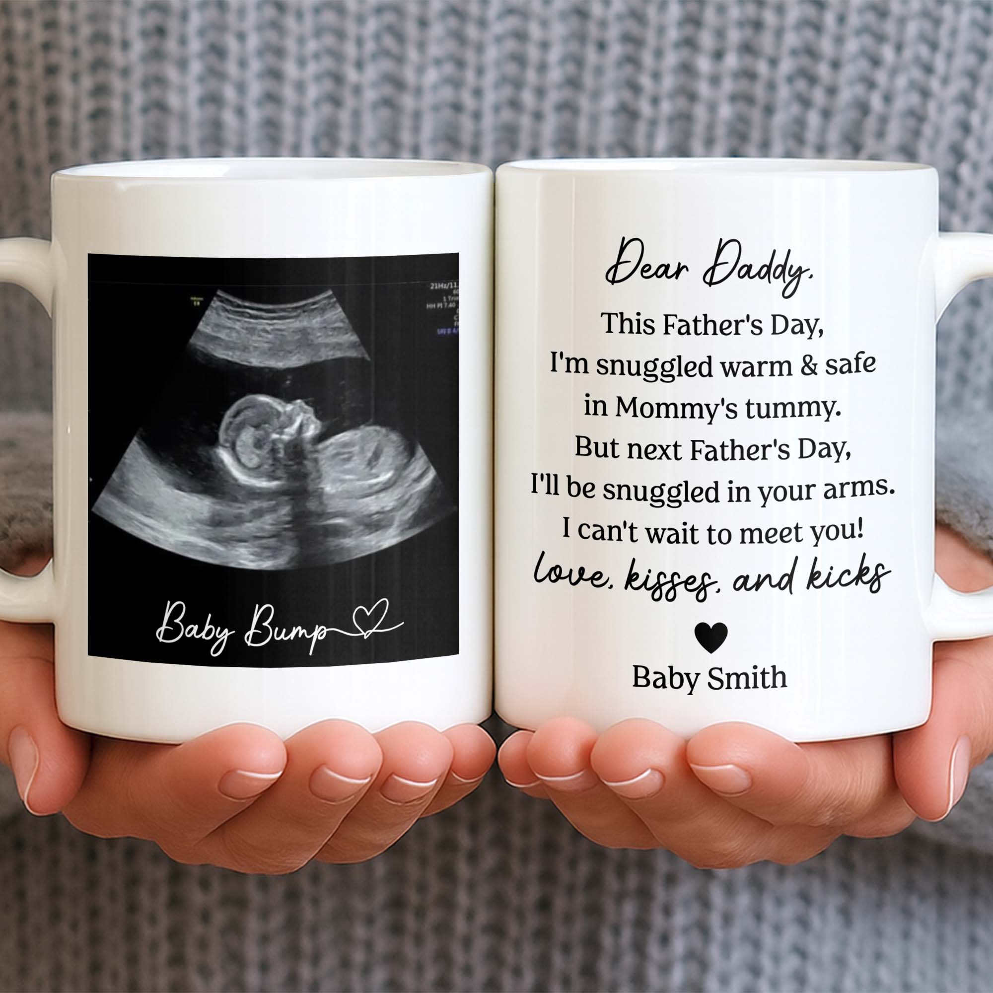 Personalized Father's Day Photo Mug Custom Ultrasound Gift for Dad Edge-to-edge Mug GradoCreations