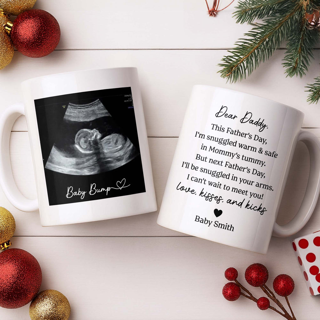 Personalized Father's Day Photo Mug Custom Ultrasound Gift for Dad Edge-to-edge Mug GradoCreations