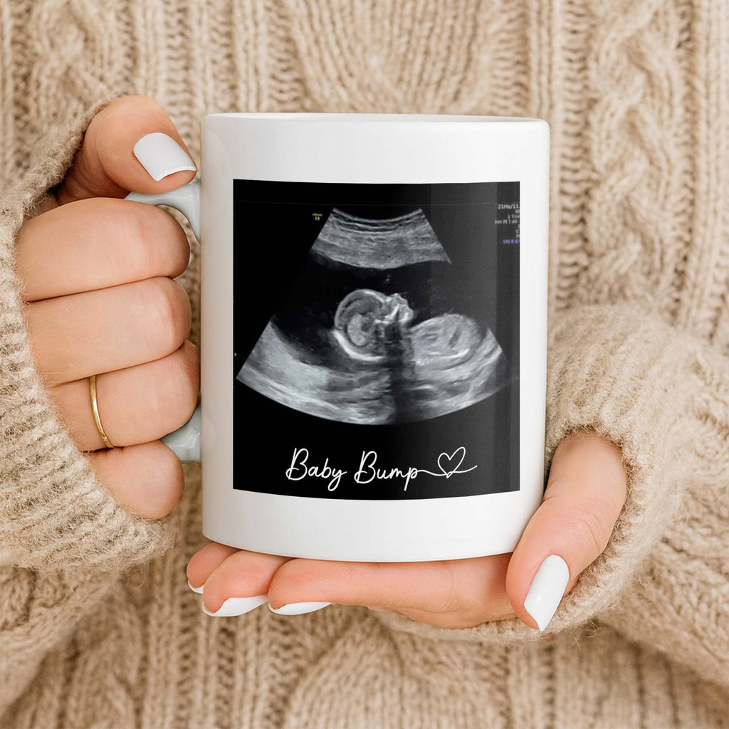 Personalized Father's Day Photo Mug Custom Ultrasound Gift for Dad Edge-to-edge Mug GradoCreations