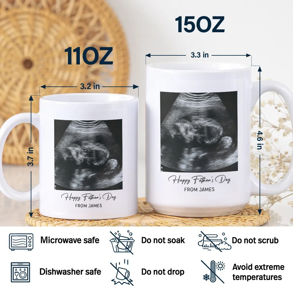 Personalized Photo Mug Custom Baby Scan Gift for Father's Day HN590 - mug GradoCreations