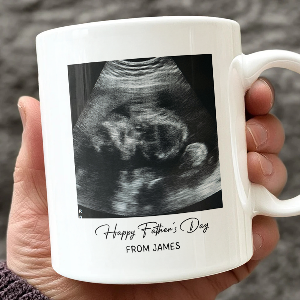 Personalized Photo Mug Custom Baby Scan Gift for Father's Day HN590 - mug GradoCreations