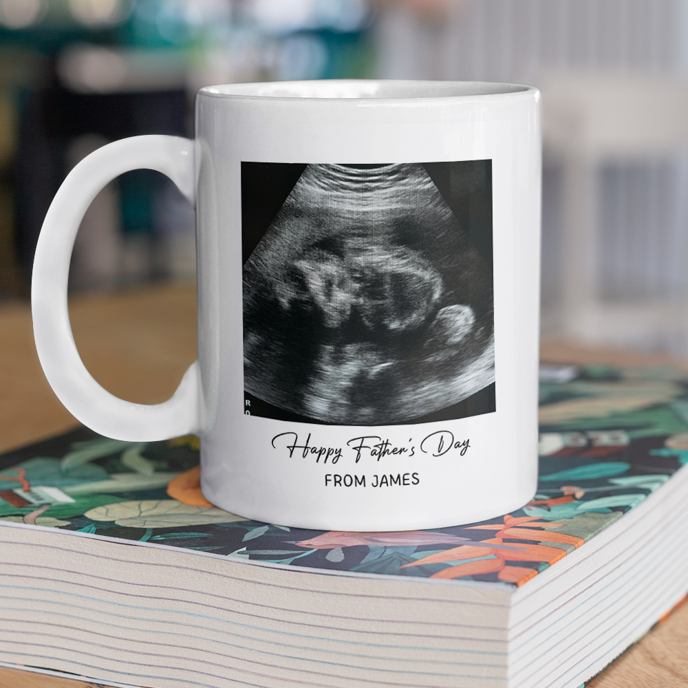 Personalized Photo Mug Custom Baby Scan Gift for Father's Day HN590 - mug GradoCreations