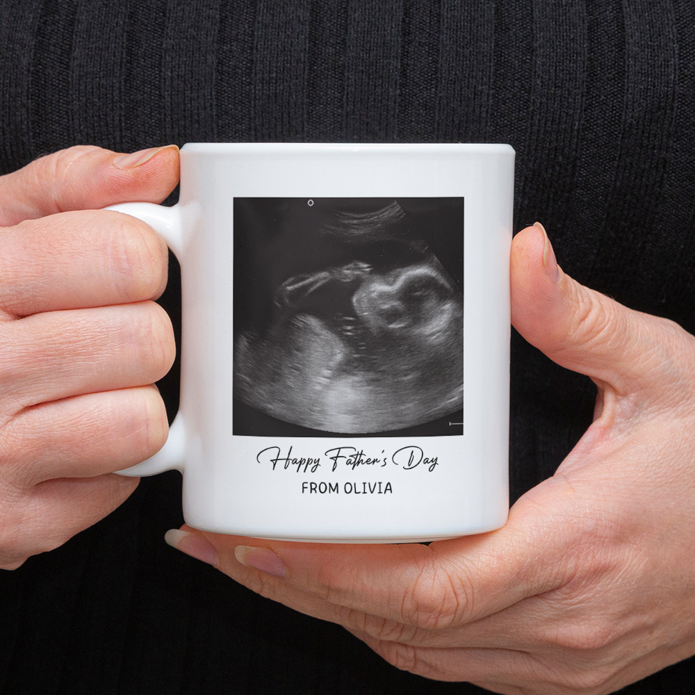Personalized Photo Mug Custom Baby Scan Gift for Father's Day HN590 - mug GradoCreations