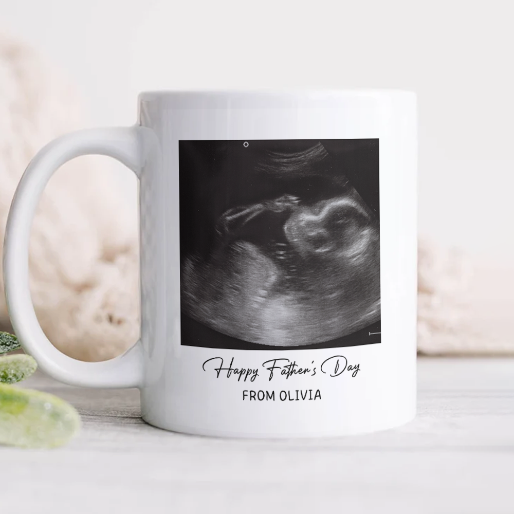 Personalized Photo Mug Custom Baby Scan Gift for Father's Day HN590 - mug GradoCreations