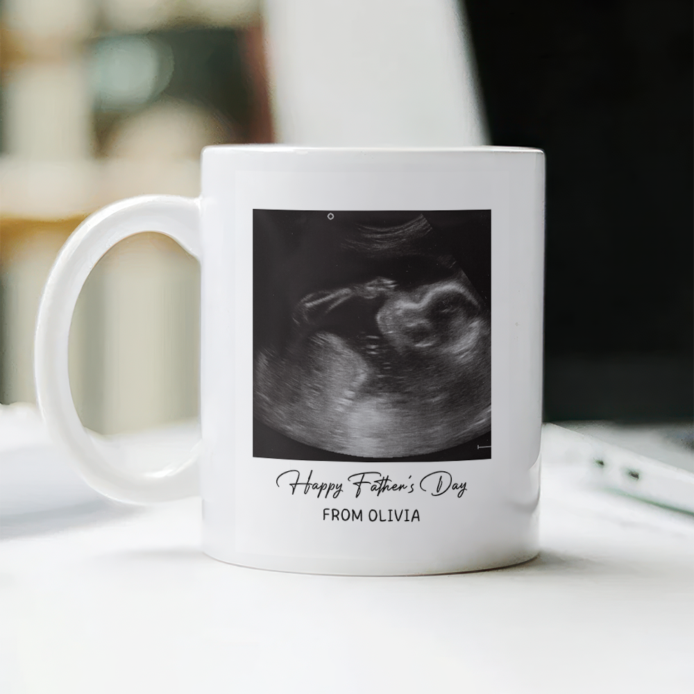 Personalized Photo Mug Custom Baby Scan Gift for Father's Day HN590 - mug GradoCreations